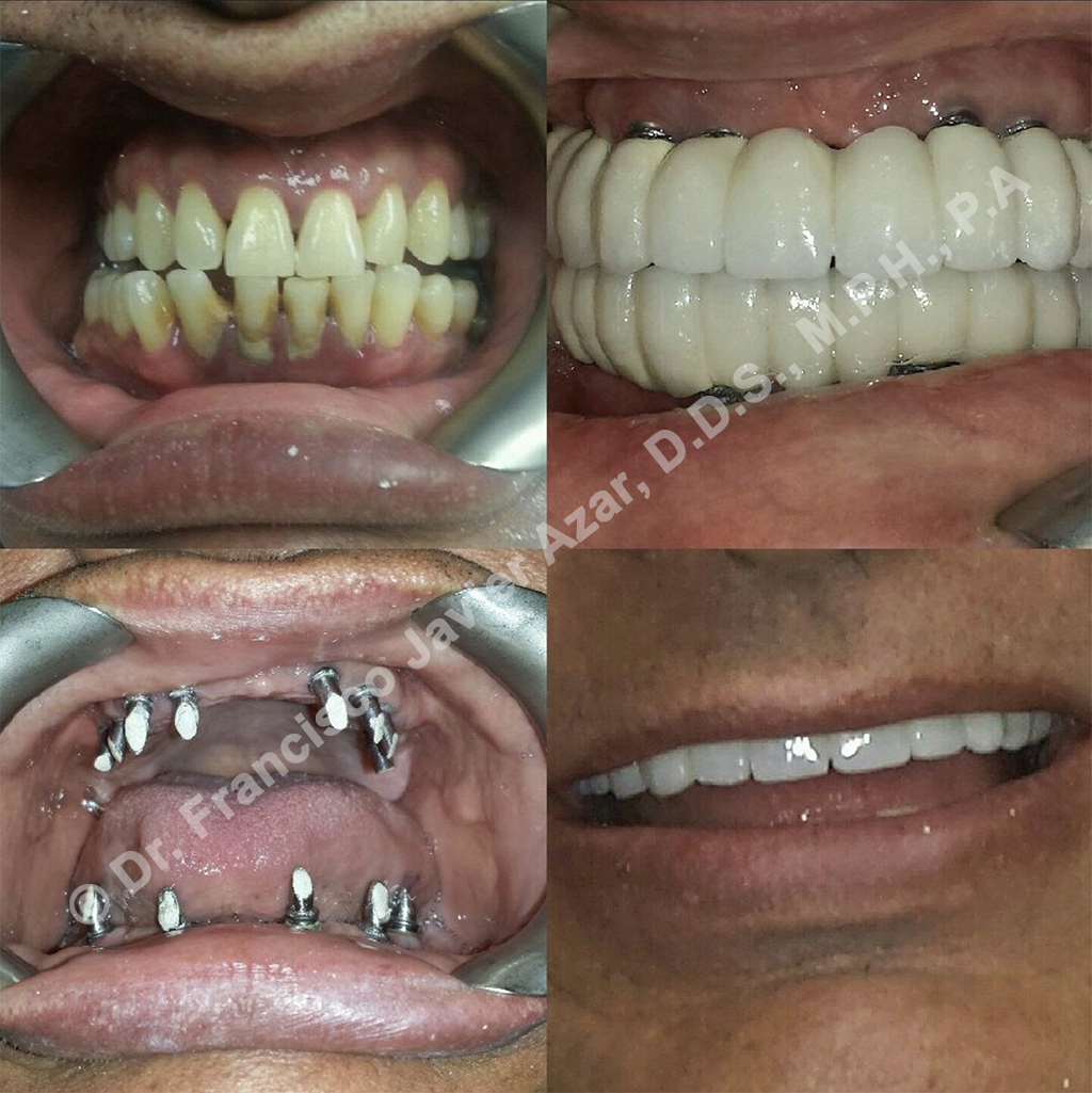 dentist in north miami beach fl